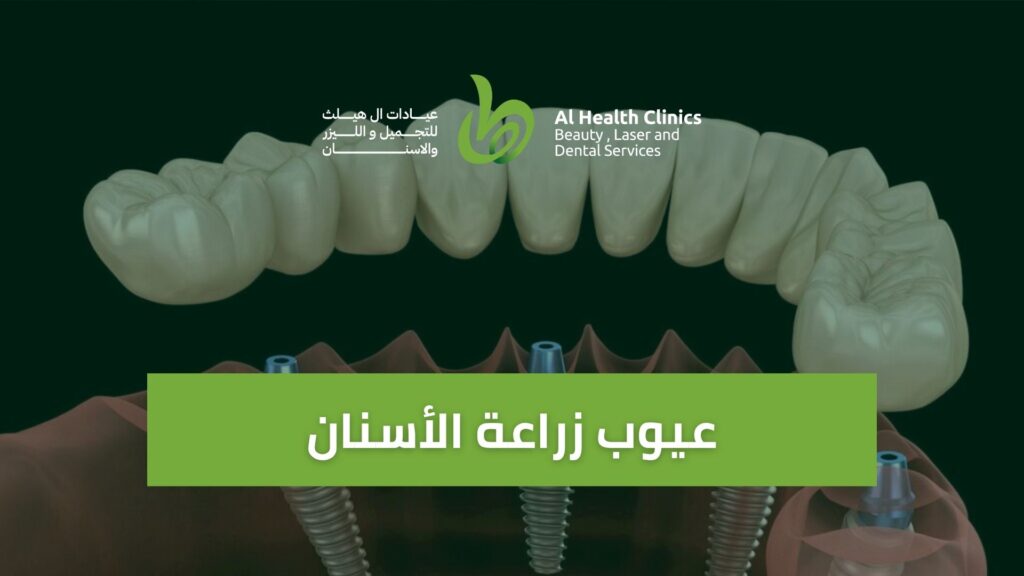 عيوب زراعة الأسنان