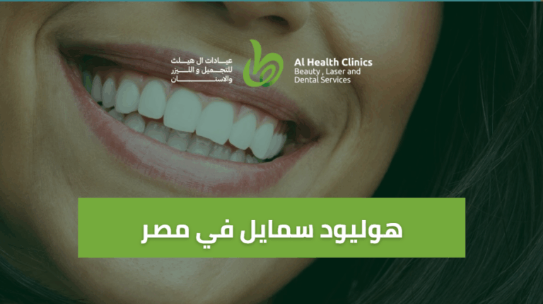 هوليود سمايل في مصر