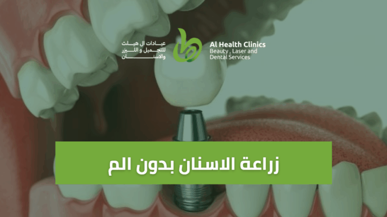 زراعة الأسنان بدون ألم