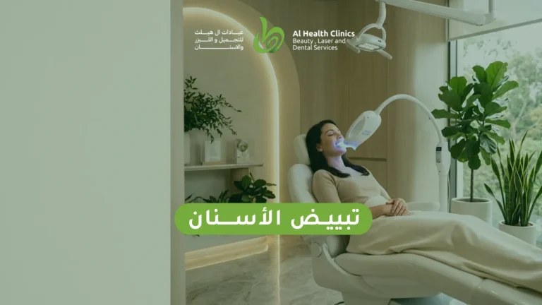تبييض الأسنان