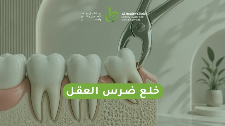 خلع ضرس العقل