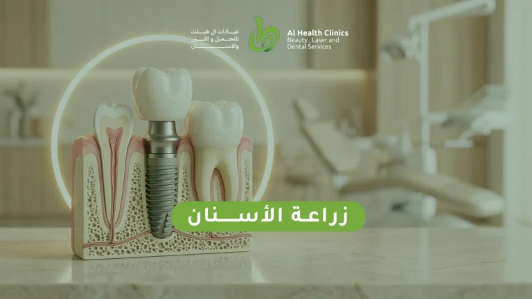 زراعة الأسنان