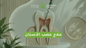 علاج عصب الأسنان