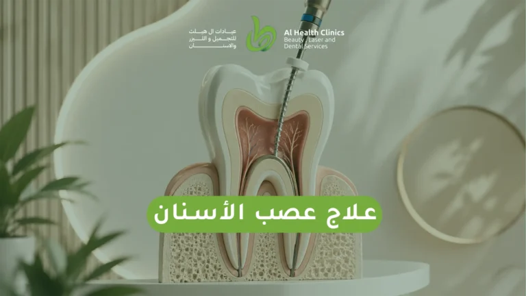 علاج عصب الأسنان