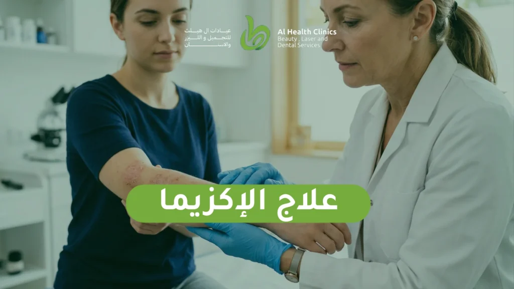 علاج الإكزيما