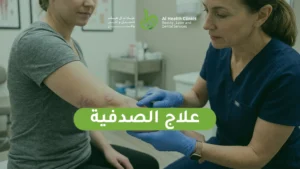 علاج الصدفية